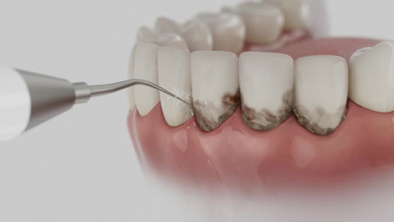 Reliable Dental contractor in St. Ann, MO by Smile Center Dentistry
